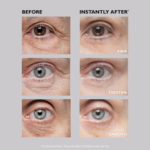 Instant FIRMx Eye Temporary Eye Tightener