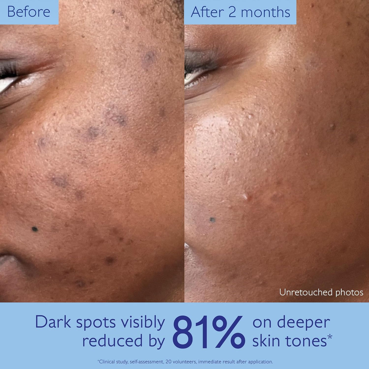 Caudalie Vinoperfect Brightening Dark Spot Serum Vitamin C Alternative - 62x More Effective than Vitamin C with Viniferine for a Visibly Brighter Even Complexion