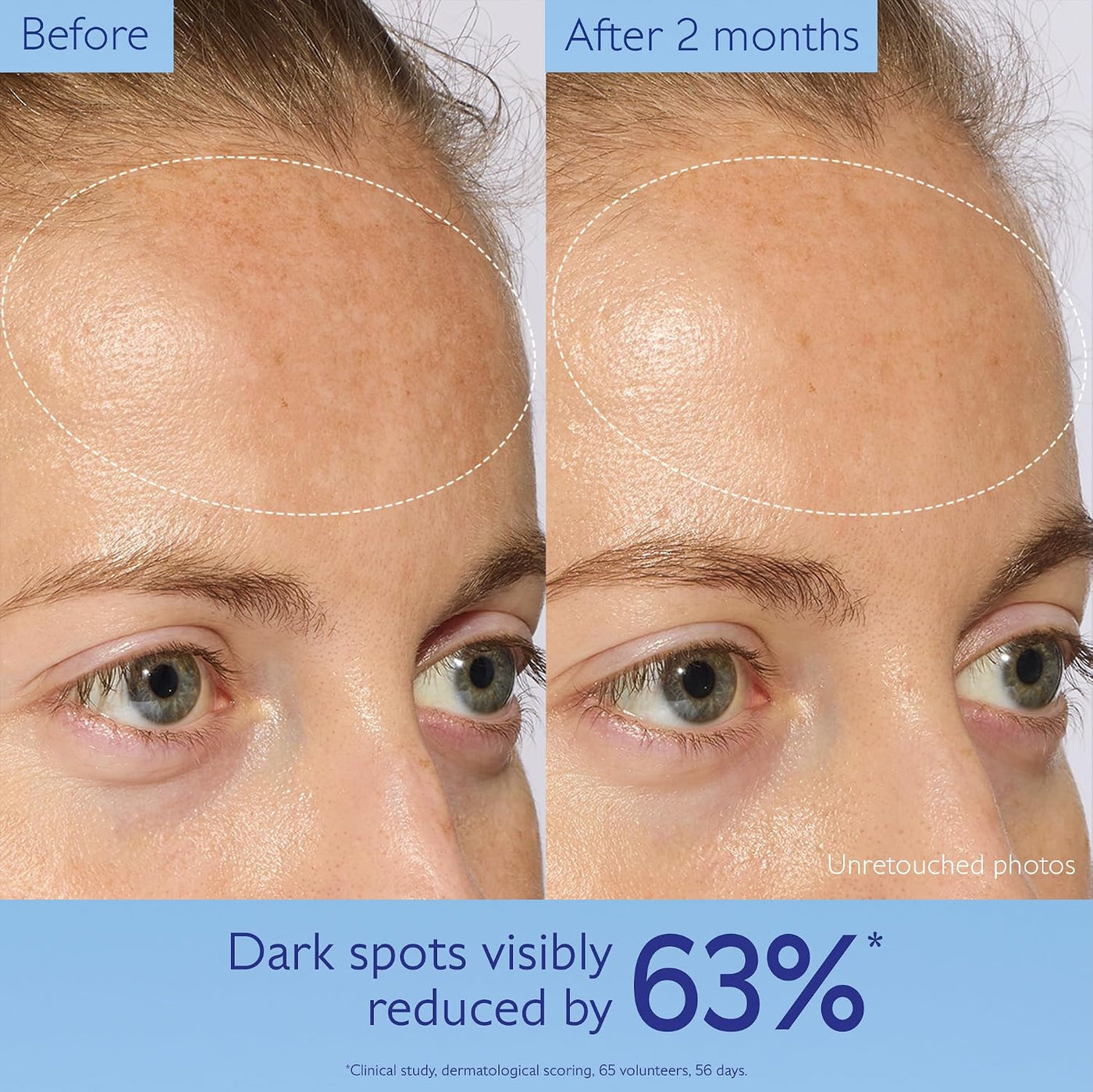 Caudalie Vinoperfect Brightening Dark Spot Serum Vitamin C Alternative - 62x More Effective than Vitamin C with Viniferine for a Visibly Brighter Even Complexion